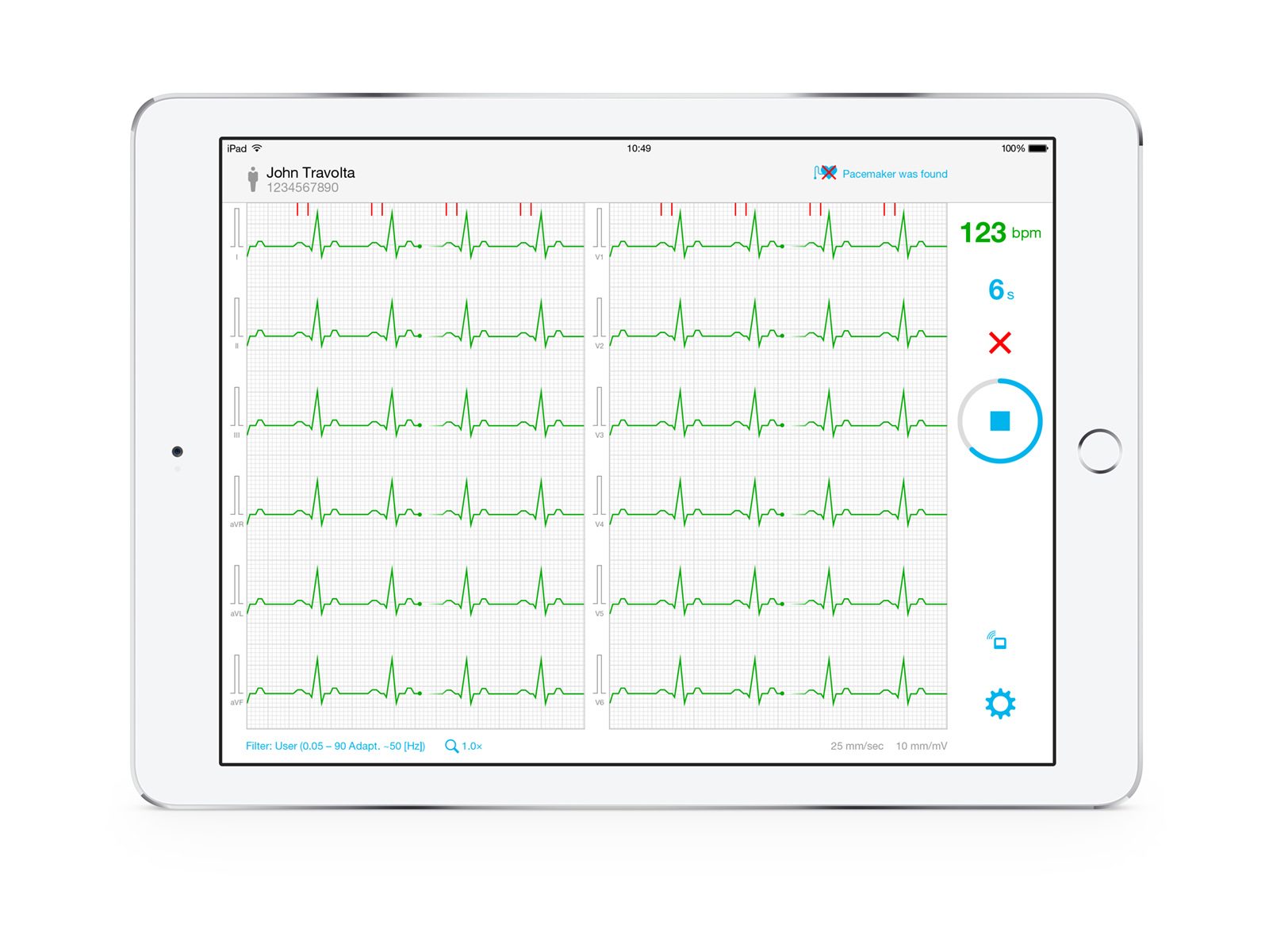 Cardio_iPad_GUI_05